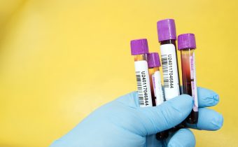 Cum îți faci analize gratuite prin sistemul public