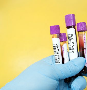 Cum îți faci analize gratuite prin sistemul public